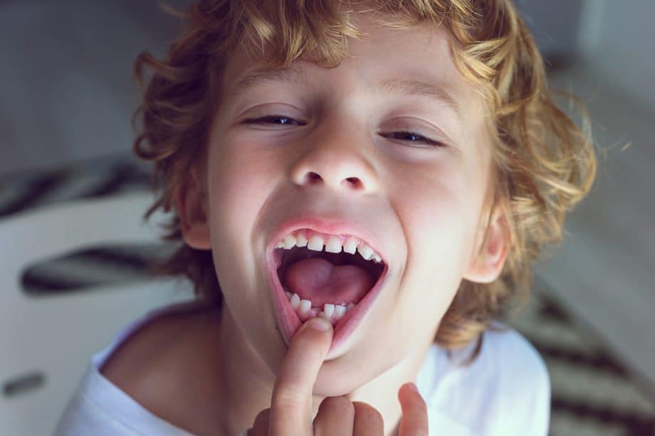 What to Do if Your Child Knocks Out a Tooth in Gaithersburg, MD
